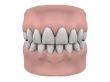 Teeth and gums