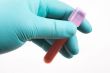 blood sample