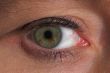 green eye
