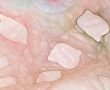 Caverns against White