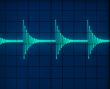 Display of Waveforms