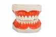 dentures, dental prosthesis