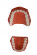 dentures, dental prosthesis