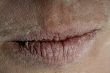 mouth