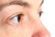 Eye closeup
