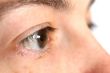 Eye closeup