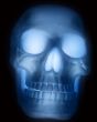 X-Ray