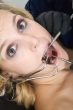 Dentist`s patient