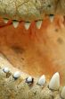 crock teeth