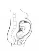 pregnant woman