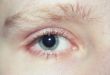 Blue Eye
