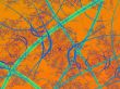 Autumn Canopy