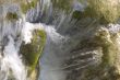 cataract
