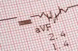 cardiographical test results