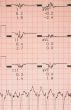 cardiological tests results