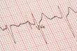 cardiological tests results