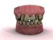 bad teeth