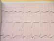 verify my ECG