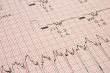 cardiological test results