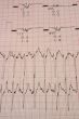 cardiological test results