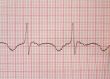 cardiological test results