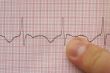 ECG with finger