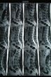 MRI result 2