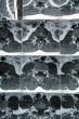 MRI result 3