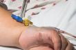 Patient with IV