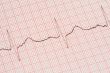 ECG printout