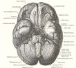 Dissection of the human brain