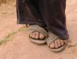Poor child feets