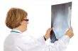Doctor analyzing a radiography
