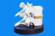 Spinal disk