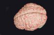 Human brain