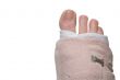 Broken Foot