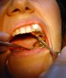 Patient in the dental clinic