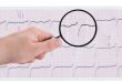 closer look at ECG printout