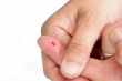 Thumb from a Bloody Finger
