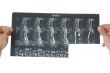 x-ray photo