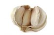 Fresh Garlic