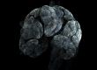 Brain