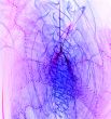 ink explosion