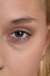 open eye
