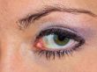 Womans Eye