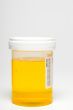 Urine Sample
