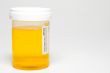 Urine Sample