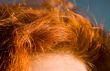Red hair