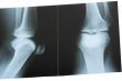 X-Ray Photo
