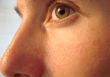 eye macro